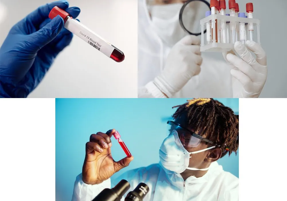 application of vacuum blood collection citrate tube application of vacuum blood collection citrate tube